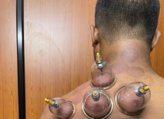 भद्रावतीत केरलीय पंचकर्म ट्रेनिंग इन्स्टिट्यूट द्वारा निःशुल्क दर्द रोग निवारण शिबिर ४ फेब्रुवारीला